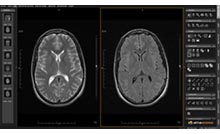 Gestión de series de imágenes
