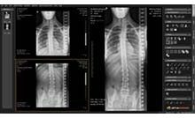Herramienta de costura de imágenes