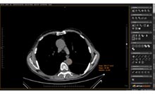 Herramientas avanzadas para la medición